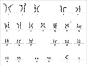 Cytogenetics | Hematologics, Inc.